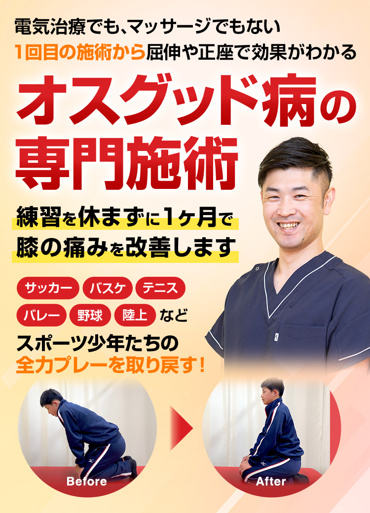 オスグッド病の専門施術